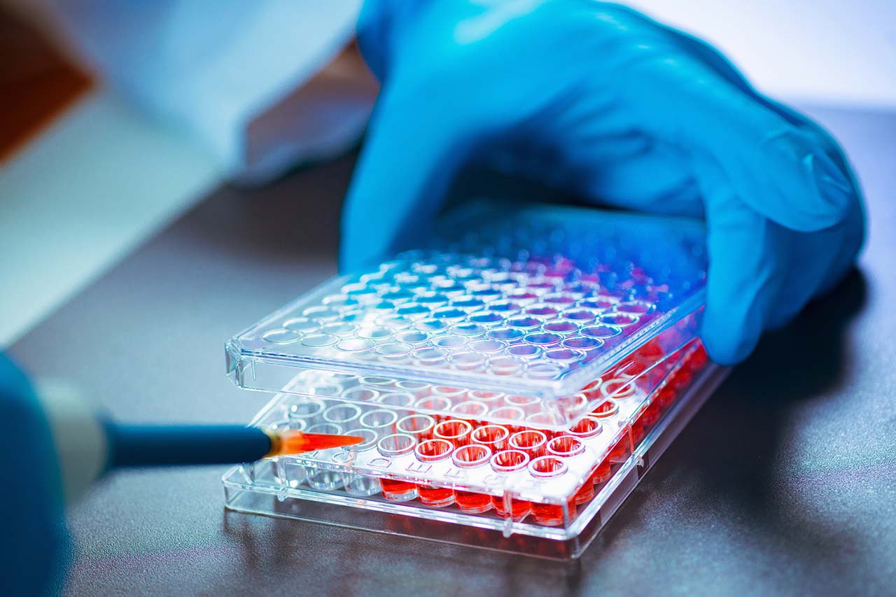 belgian biotech agency consulting consultancy experts