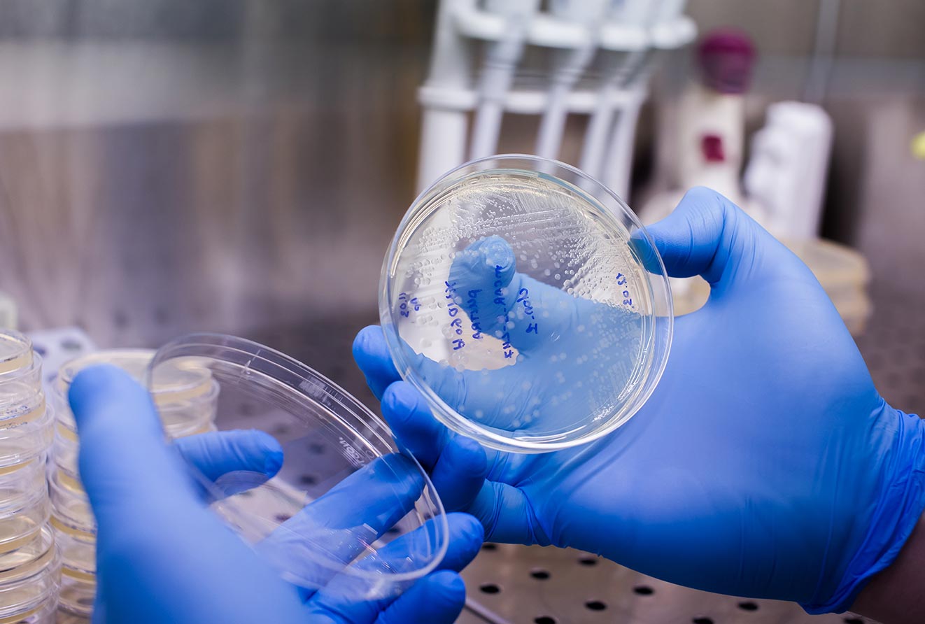 CAR-T cells agence cabinet conseil consulting