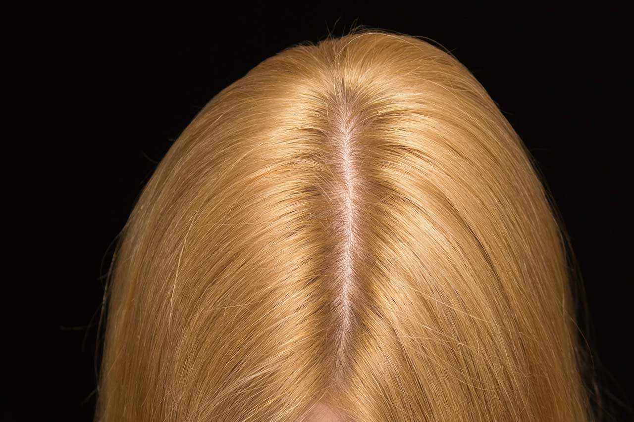 scalp care agence cabinet conseil consulting