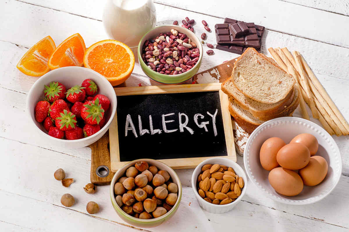food allergy management agency consulting consultancy experts