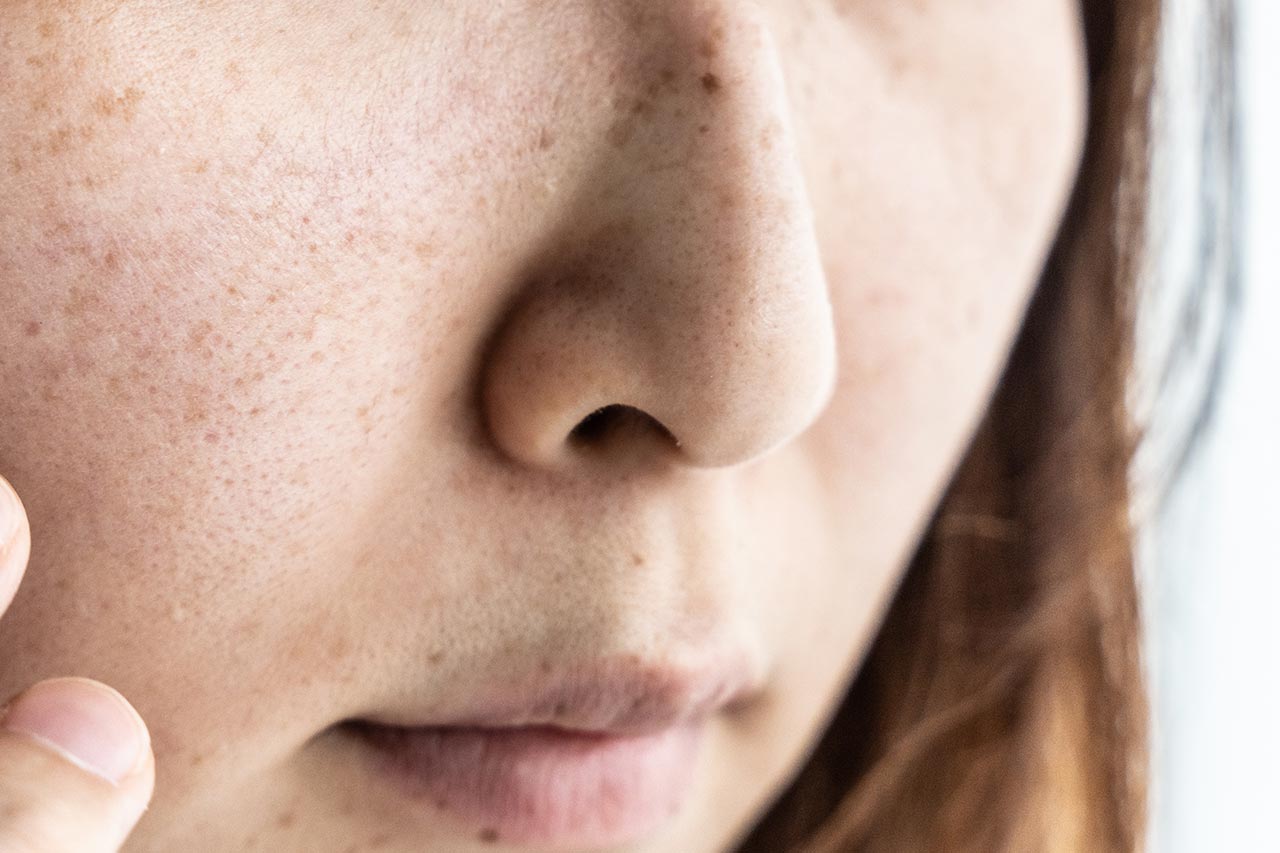 Skin microbiota agence cabinet conseil consulting