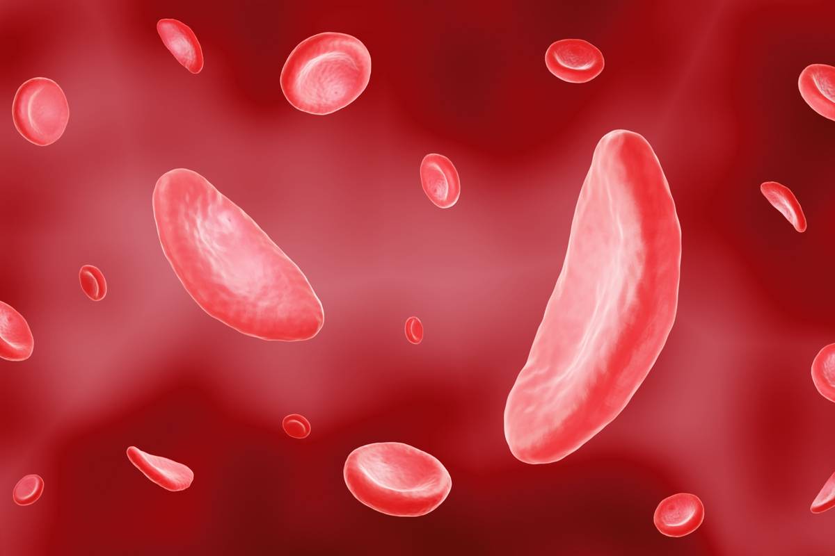 SCD medication agency consulting consultancy experts